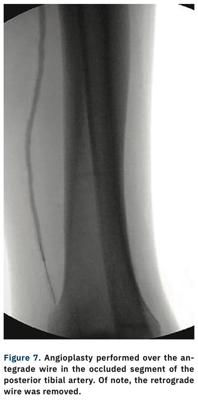 Modified CART Technique How to Maximize the Efficiency of CART and